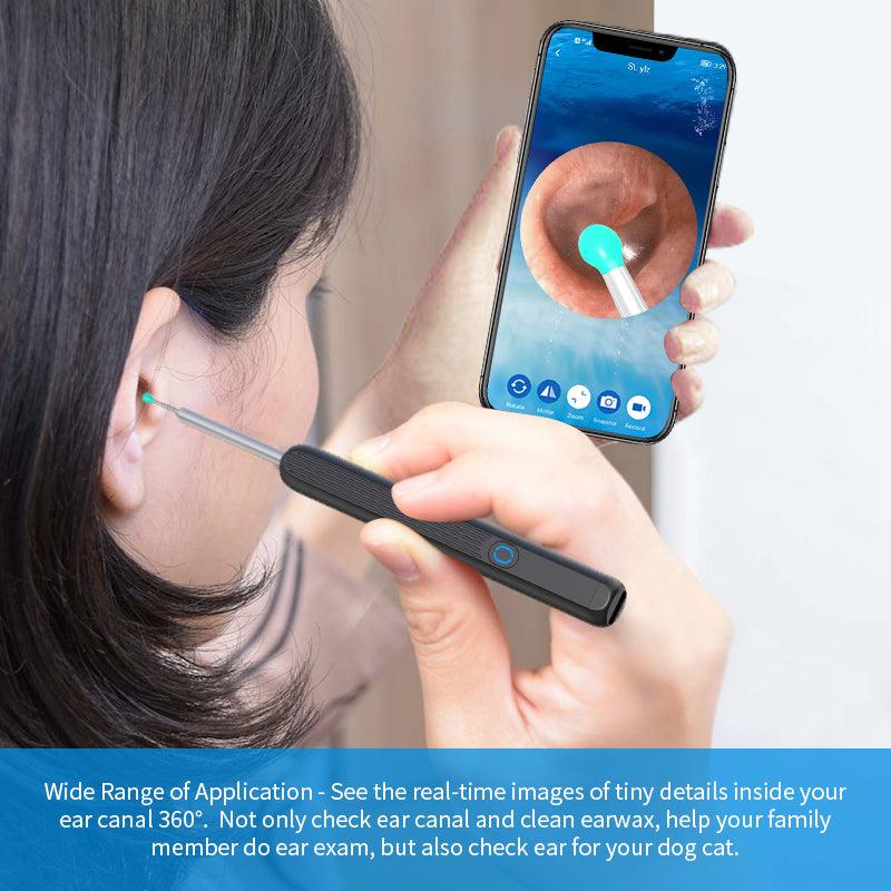 Ear Cleaner Otoscope Ear Wax Removal Tool With Camera LED Light - ThinkSmartTech